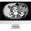ARRS Gastrointestinal Imaging Online Course 2019 (CME VIDEOS)