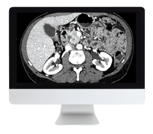 ARRS Gastrointestinal Imaging Online Course 2019 (CME VIDEOS)