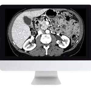 ARRS Gastrointestinal Imaging Online Course 2019 (CME VIDEOS)