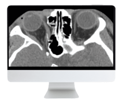 ARRS Imaging Victims of Violence: Fists, Stabs, Bullets, and Blasts 2021 (CME VIDEOS)