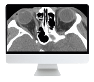 ARRS Imaging Victims of Violence: Fists, Stabs, Bullets, and Blasts 2021 (CME VIDEOS)