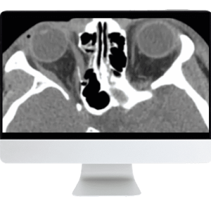 ARRS Imaging Victims of Violence: Fists, Stabs, Bullets, and Blasts 2021 (CME VIDEOS)