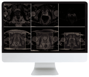 ARRS Pearls and Pitfalls in Prostate and Pelvic Imaging 2021 (CME VIDEOS)