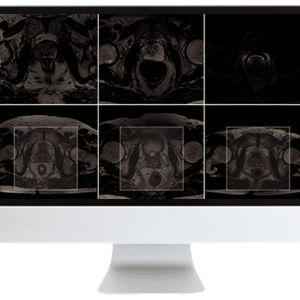 ARRS Pearls and Pitfalls in Prostate and Pelvic Imaging 2021 (CME VIDEOS)