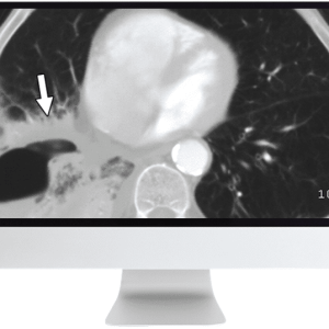 ARRS Radiology Review: Multispecialty Cases 2019 (CME Videos)