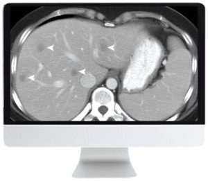 ARRS SAR Disease-Focused Panels: Cancer Imaging and Reporting Guidelines 2021 (CME VIDEOS)