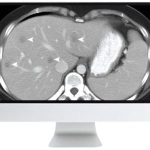 ARRS SAR Disease-Focused Panels: Cancer Imaging and Reporting Guidelines 2021 (CME VIDEOS)