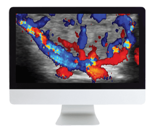 ARRS Thyroid Imaging 2019 (CME VIDEOS)