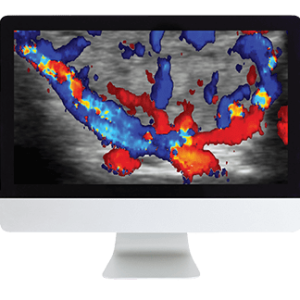 ARRS Thyroid Imaging 2019 (CME VIDEOS)