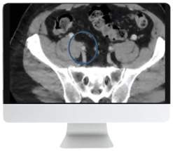 ARRS Venous Disease: Exploration of Advances, Challenges, and Future Directions 2021 (CME VIDEOS)