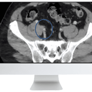 ARRS Venous Disease: Exploration of Advances, Challenges, and Future Directions 2021 (CME VIDEOS)