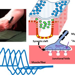 EMG/NCS Online Series: Volume XII Repetitive Nerve Stimulation