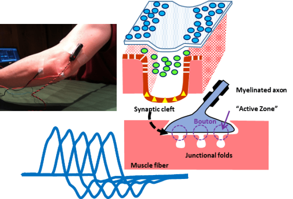 EMG/NCS Online Series: Volume XII Repetitive Nerve Stimulation