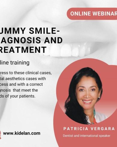 Gummy Smile – Diagnosis and Treatment