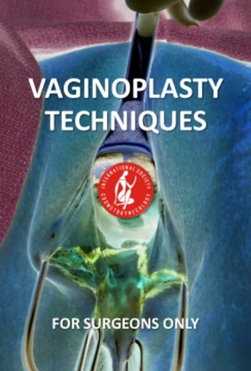 ISCG Vaginoplasty Techniques for Surgeons