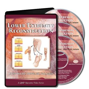 Lower Extremity Reconstruction