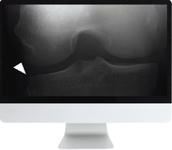 Musculoskeletal Imaging for the Practicing Radiologist 2018 (ARRS VIDEOS) (CME VIDEOS)