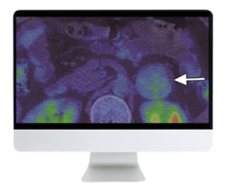 ARRS Breakthroughs in Nuclear Medicine for Neurology and Oncology 2021 (CME VIDEOS)