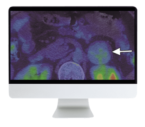 ARRS Breakthroughs in Nuclear Medicine for Neurology and Oncology 2021 (CME VIDEOS)