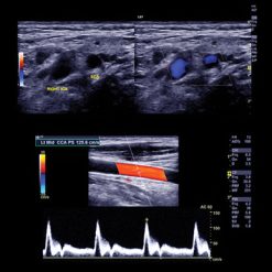 Oakstone Clinical Approach to Vascular Ultrasound and RPVI Prep Course 2021