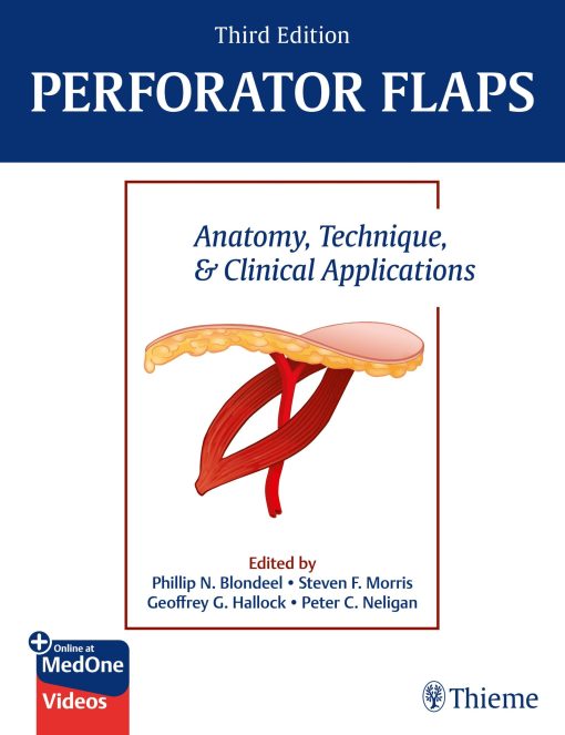 Perforator Flaps: Anatomy, Technique, & Clinical Applications, 3rd Edition (Original PDF From Publisher+Videos)