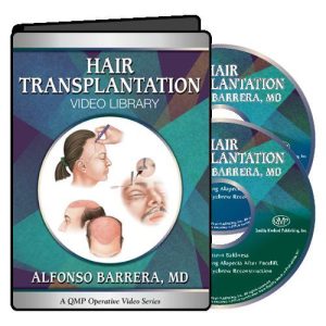 Hair Transplantation