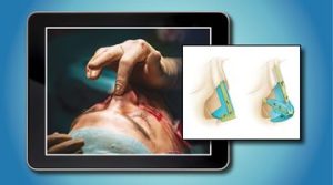 QMP e Learning Program – plastic surgery