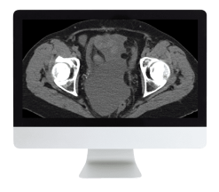 Radiologic Reasoning: A Rapid-Fire Multispecialty Review 2018 (ARRS VIDEOS) (CME VIDEOS)