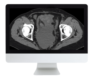 Radiologic Reasoning: A Rapid-Fire Multispecialty Review 2018 (ARRS VIDEOS) (CME VIDEOS)