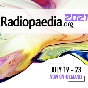 Radiopaedia 2021 (July 19 – 23) Videos