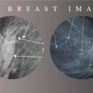 Advanced Breast Imaging 2024 – CMEScience (Videos)