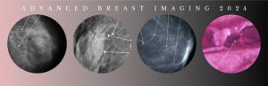 Advanced Breast Imaging 2024 – CMEScience (Videos)