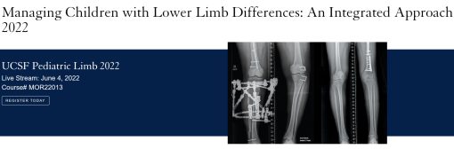 Managing Children with Lower Limb Differences: An Integrated Approach 2022