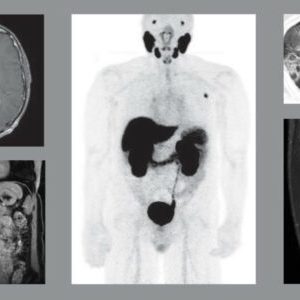 UCSF Radiology Annual Review – 2024