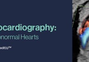 Fetal Echocardiography Normal and Abnormal Hearts ( CME VIDEOS ) 2021