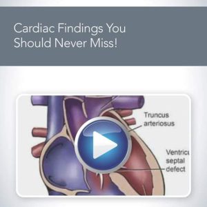 AIUM Cardiac Findings You Should Never Miss!