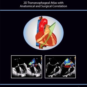 The Art Of 2D Transesophageal Echocardiography (Videos Only)