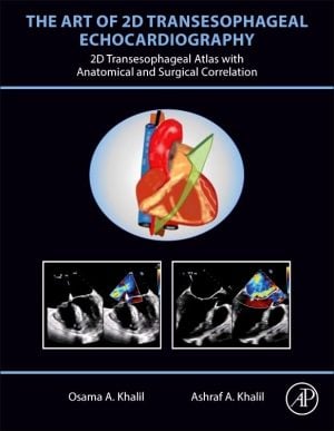 The Art Of 2D Transesophageal Echocardiography (Videos Only)