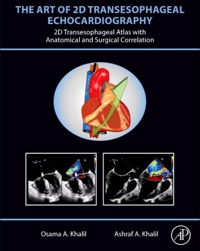 The Art Of 2D Transesophageal Echocardiography (Videos Only)