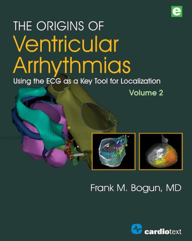 The Origins of Ventricular Arrhythmias Using the ECG as a Key Tool for Localization