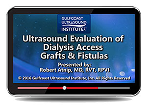 Ultrasound Evaluation of Dialysis Access Grafts & Fistula