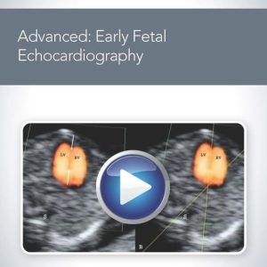 Advanced: Early Fetal Echocardiography