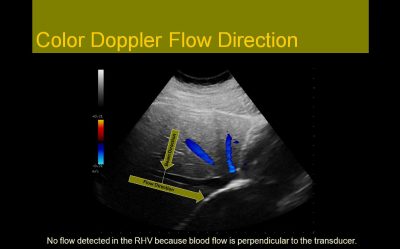 Sonographic Principles and Instrumentation: A Comprehensive Review