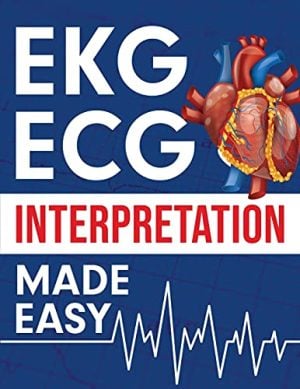 EKG | ECG Interpretation Made Easy: An Illustrated Study Guide For Students To Easily Learn How To Read & Interpret ECG Strips (EPUB)