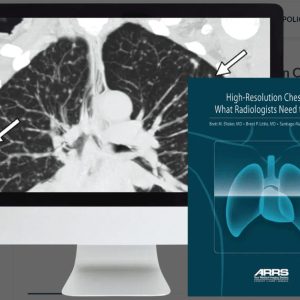 ARRS High-Resolution Chest CT 2024