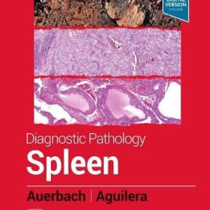 Diagnostic Pathology: Spleen, 2nd Edition (Original PDF from Publisher)