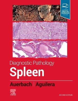 Diagnostic Pathology: Spleen, 2nd Edition (Original PDF from Publisher)