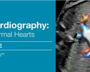 2018 Fetal Echocardiography: Normal and Abnormal Hearts (CME Videos)