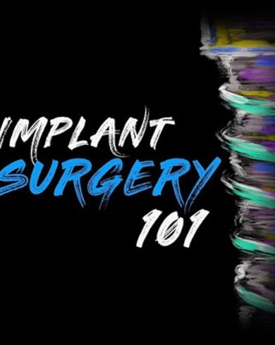 Implant Surgery 101 – Implant Ninja