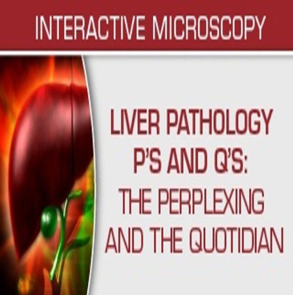 USCAP Liver Pathology P’s and Q’s: The Perplexing and the Quotidian 2022